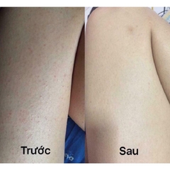 KEM BODY 2% BHA PAULACHOICE SKIN REVEALING BODY LOTION