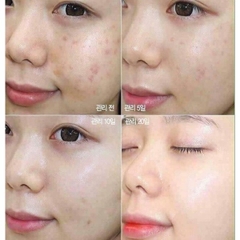 SERUM SKIN1004 MADAGASCAR CENTELLA AMPOULE