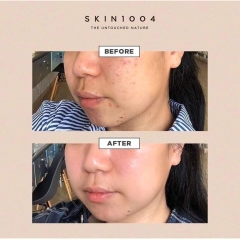 SERUM SKIN1004 MADAGASCAR CENTELLA AMPOULE