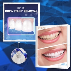 KEM ĐÁNH RĂNG CREST 3D WHITE ADVANCED TRIPLE WHITENING - 158G