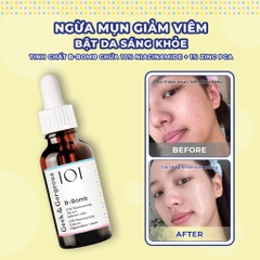 Tinh Chất Geek & Gorgeous B-Bomb 10% Niacinamide 30ml - Kiểm Soát Dầu