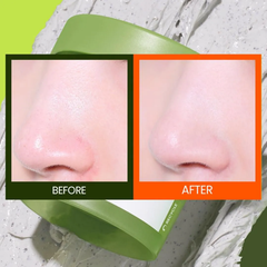 Mặt nạ đất sét Beplain Mung Bean Pore Clay Mask 120ml
