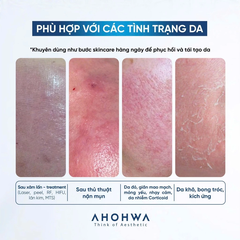 Mặt Nạ Phục Hồi Giảm Đỏ Ahohwa Vitamin K Calming Mask
