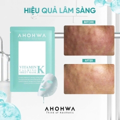 Mặt Nạ Phục Hồi Giảm Đỏ Ahohwa Vitamin K Calming Mask