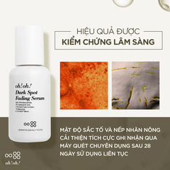 Tinh chất oh!oh! Dark Spot Fading Serum 30ml - Giảm thâm nám và ngăn lão hóa