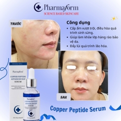 Tinh Chất Pharmaform Copper Peptide 30ml - Phục Hồi, Trẻ Hóa & Làm Dịu Da
