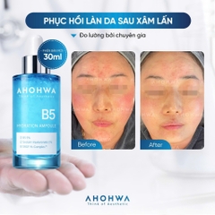 Tinh Chất Ahohwa Hydration Ampoule B5 30ml - Cấp Ẩm, Phục Hồi & Làm Dịu Da