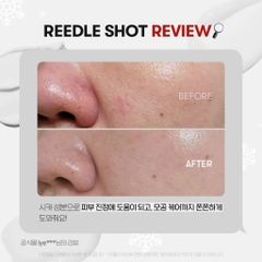 [HỒNG] 100 VT REEDLE SHOT