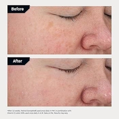 0.5% REVISION RETINOL COMPLETE
