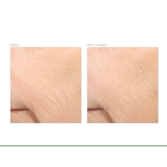 0.5% REVISION RETINOL COMPLETE