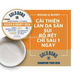 Kem dưỡng da Gold Bond Rough and Bumpy Cream làm mịn sáng da 226g