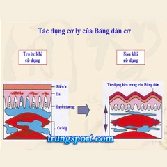 Băng Dán Cơ Thể Thao - Giảm Căng Cơ, Phục Hồi Cơ Bắp Vượt Trội