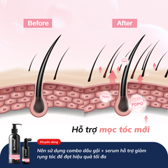 Serum giảm rụng tóc, kích thích chân tóc phát triển, chăm sóc da đầu Dr.PONG Tsutsuji Hair Rejuvenating - anti- hairloss