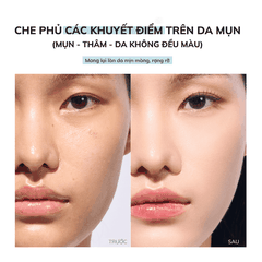 Phấn nước dành cho da dầu mụn Dr.PONG Acne Ace Longwear Cushion 15g