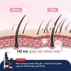 Serum hỗ trợ giảm rụng tóc Dr.PONG Tsutsuji Hair Rejuvenating Serum