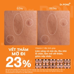 Serum Vitamin C dưỡng trắng, mờ thâm,thu nhỏ lỗ chân lông và chống oxy hóa Dr.Pong 15c Antioxidant Vitamin C Shake Shake