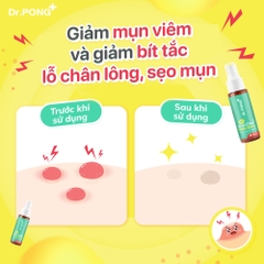 Xịt dưỡng hỗ trợ giảm mụn cơ thể Dr.PONG B3 Acne Clear Body Spray 60ml