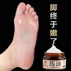 Kem cao ngựa, trị nứt nẻ toàn thân, tay chân, gót chân