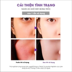Mặt Nạ Super Clam Repairing Mask Phục Hồi Làm Dịu Da Cấp Tốc