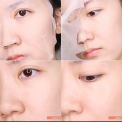 Mặt Nạ Some By Mi