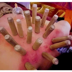 Bộ 10 Ông Tre Nặn Mụn Lăn Ống Tre, Bộ Ống giác hơi tre trúc