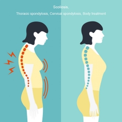 Dụng Cụ Chỉnh Nắn Xương Cột Sống Chiropractic Adjustment Tool Activation Therapy Limbs Joint Corrector Care