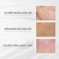 Kem dưỡng chuyên sâu ngăn ngừa lão hoá 45g