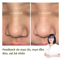 Gói Hỗ Trợ Điều Trị Mụn và Kiểm Soát Dầu 1 - 3 tháng| Dành cho da dày, khỏe (có chuyên viên theo dõi 1:1)