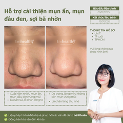 Combo 2 Chống nắng, hỗ trợ điều trị mụn và nám, phục hồi toàn diện tại nhà | Có HLV đồng hành 3 tháng