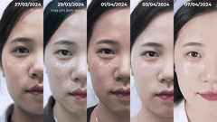 Vi sinh 2.0 dành cho da nhạy cảm| Mỹ phẩm vi sinh Hoa Ngân