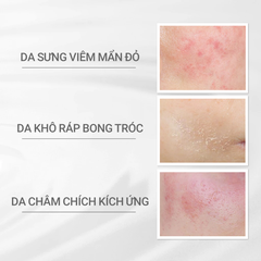 Kem dưỡng ẩm phục hồi SKIN REPAIR CREAM 45g | Dòng dưỡng vi sinh
