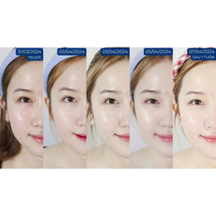 Combo 1 Xịt Dưỡng, Sữa rửa mặt & Kem Chống Nắng | Mỹ phẩm vi sinh Hoa Ngân