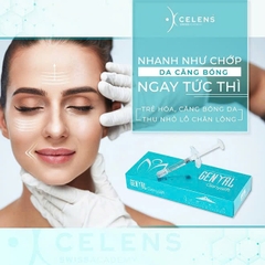 GENYALIFT – FILLER CĂNG BÓNG TRẺ HÓA DA CAO CẤP TỪ THỤY SĨ