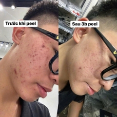 Image I Enhance Retinol Facial Enhancer – Tinh chất trẻ hóa da 14.8ml