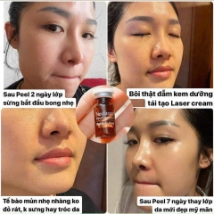 PEEL DA SINH HỌC NEOSTRATA RETINOL 3% – LỘT XÁC LÀN DA CHỈ SAU 7 NGÀY