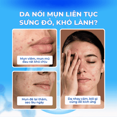 CHẤM MỤN G1 AC CONTROL SOLUTION 30ML (G.LOV.U G1 AC CONTROL SOLUTION8809626569135)