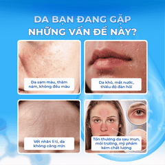 KEM NỮ HOÀNG HỒNG ỐC SÊN 60ML(QUEEN CHARM PREMIUM INTENSIVE SNAIL DAY&NIGHT CREAM-8809936050187)