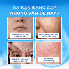KEM NỮ HOÀNG TÍM CAO CẤP 50ML (QUEEN CHARM VOLUX PREMIUM CREAM8809514487688)