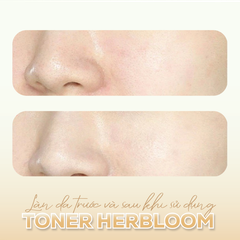 Toner dạng xịt Kombucha plant biome toner Thương hiệu: Herbloom 150ml/chai