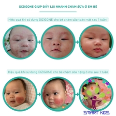 Dung Dịch Kháng Khuẩn Dizigone 300ml