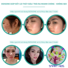 Kem Bôi Da Dizigone Nano Bạc - Kháng Khuẩn, Lành Vết Thương, Tái Tạo Da, Ngăn Ngừa Sẹo 25g