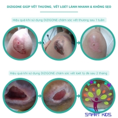 Dung Dịch Kháng Khuẩn Dizigone Spray 100ml dạng xịt