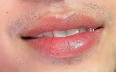 Khử thâm môi tự nhiên cho nam