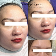 Khắc sợi chân mày Nano Brows