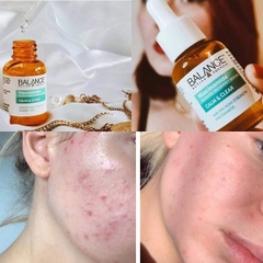 Serum dưỡng da Balance Active Formula Niacinamide Blemish Recovery 30ml