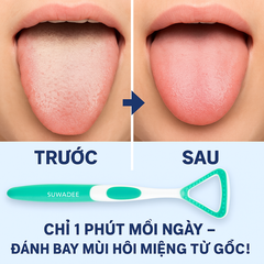 Dụng cụ cạo lưỡi HT8029 - Hộp 50 Cây - TONGUECLEANER