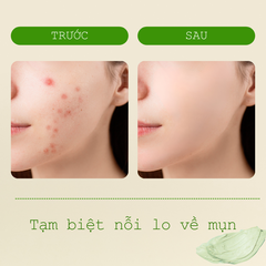 Mặt Nạ Đất Sét Rau Má Ngừa Mụn Mịn Da