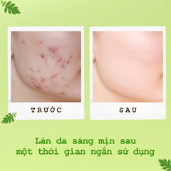 Mặt Nạ Ngủ Ngải Cứu Ngừa Mụn Sáng Da