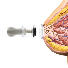 Ống Hút Kéo Núm Vú Bị Tụt Cao Cấp – Dụng Cụ Se Đầu Ti Tự Nhiên, Tăng Khoái Cảm