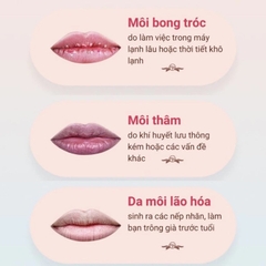 [UK] Son Dưỡng Môi Vaseline Lip Therapy Rosy Hộp Thiếc Màu Hồng 20g